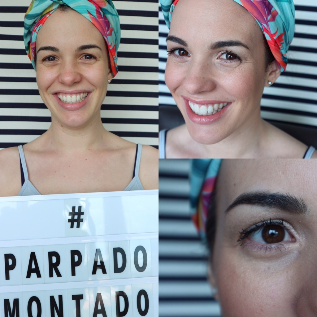 Expediente UP TO ME: Caso Párpado&nbsp;Montado