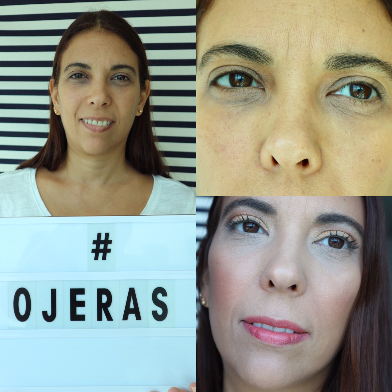 Expediente UP TO ME: Caso Ojeras