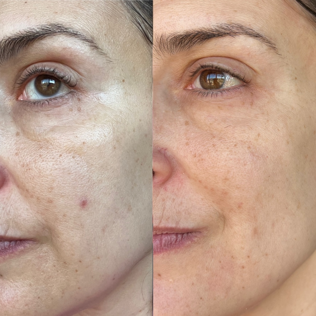 6222C0C9-2D8F-45B7-A24F-07279950D8A3