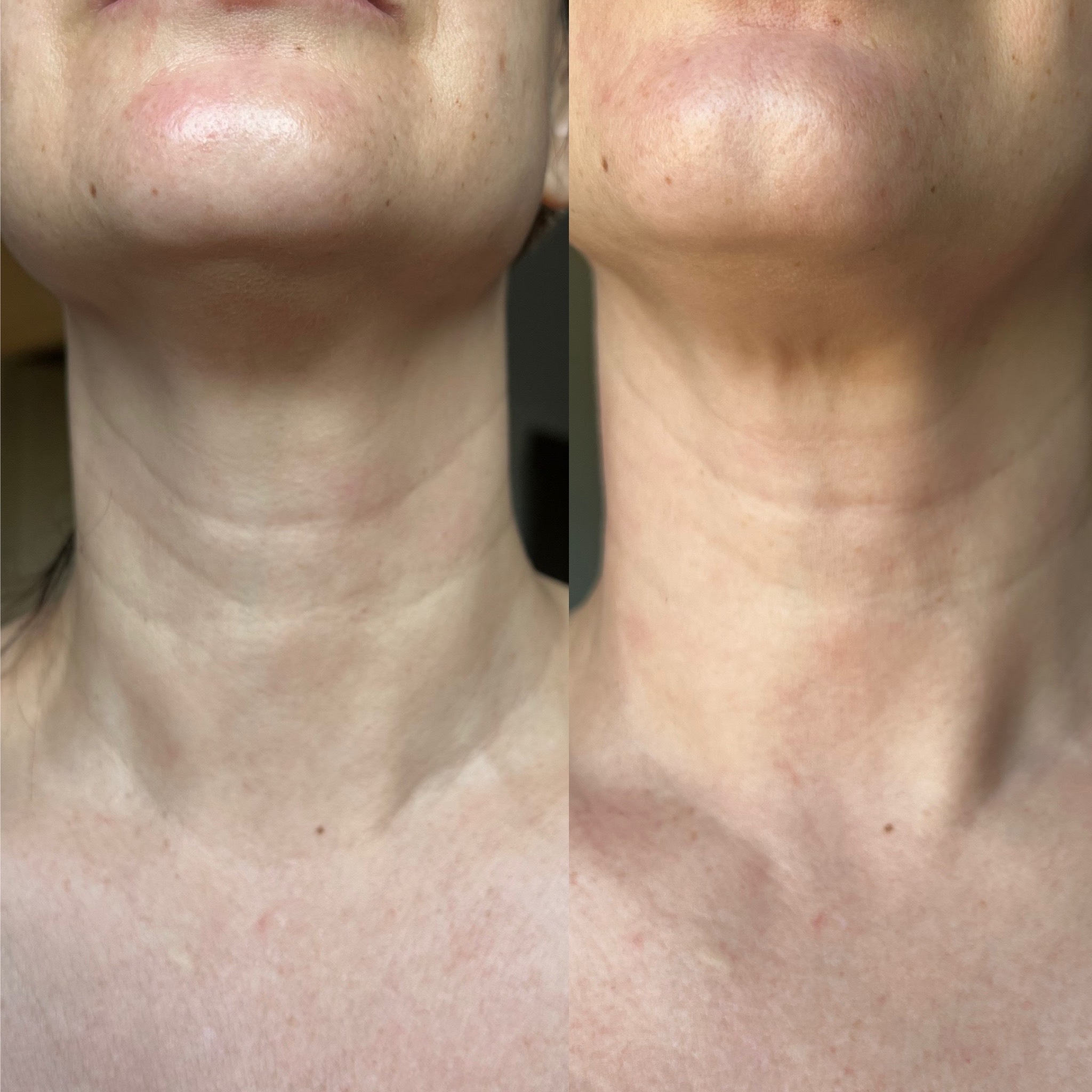 98f95cec-b59d-4688-ba16-95eb93afe65c